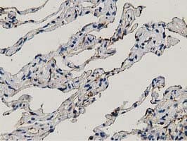 ANXA3 / Annexin A3 Antibody (clone OTI1F11)