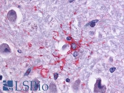 PathPlus™ Polyclonal Rabbit anti-Human DRD1 / Dopamine Receptor D1 Antibody (Cytoplasmic Domain, IHC)