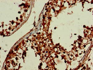 Polyclonal Rabbit anti-Human DEPDC1B Antibody (IHC, IF, WB)