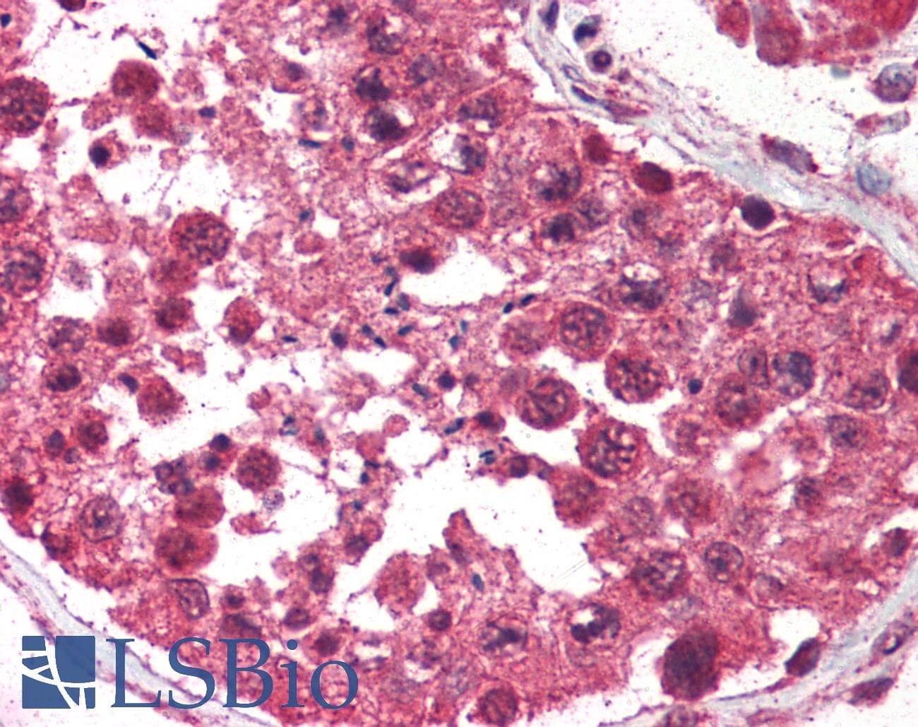 IHC-plus™ AVEN / PDCD12 Antibody