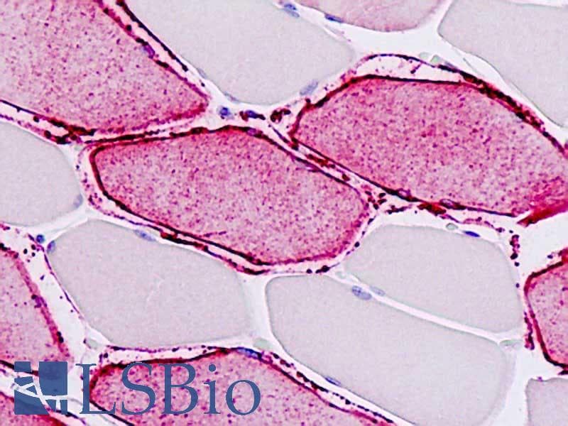 IHC-plus™ ATP2A1 / SERCA1 Antibody (aa548-597)