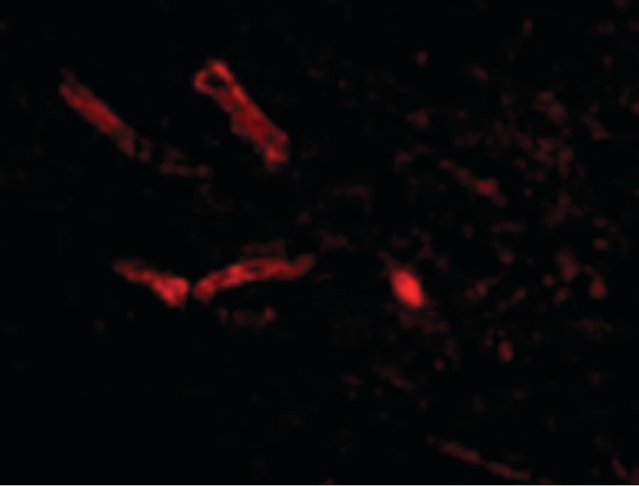 SNPH Antibody