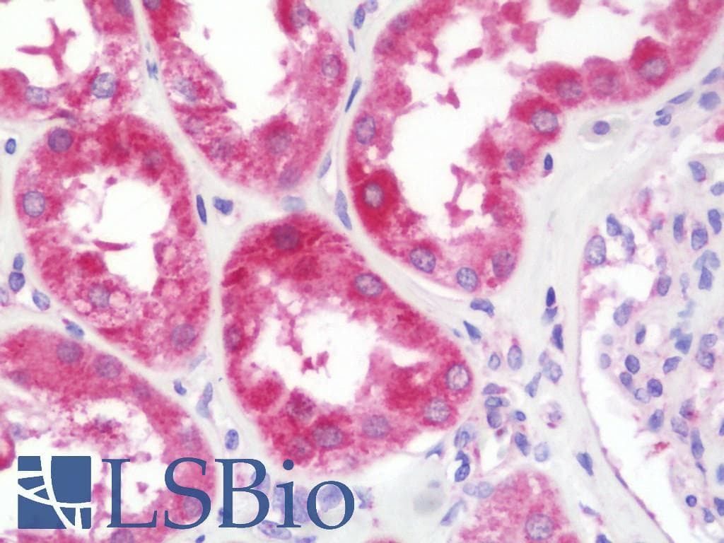 IHC-plus™ XPNPEP3 Antibody (aa12-507)