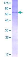 Human WNT3A Protein (Recombinant GST)