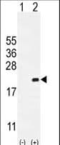 CDKN2C / p18 INK4c Antibody (aa113-139)