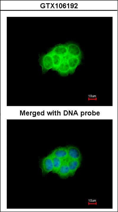 IHC-plus™ Polyclonal Rabbit anti-Human HSPA6 / HSP70B' Antibody (aa377-628, IHC, WB)