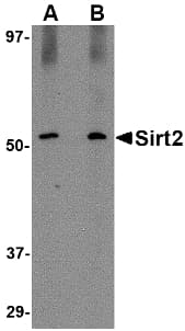 IHC-plus™ SIRT2 / Sirtuin 2 Antibody