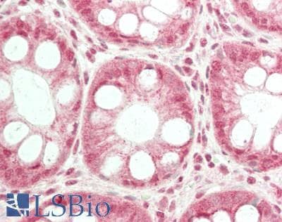 IHC-plus™ TRPC6 Antibody (aa832-846)