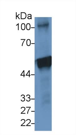 PRDX5 / Peroxiredoxin 5 Antibody (aa1-213)