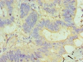 GUSB / Beta Glucuronidase Antibody (aa382-651)