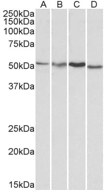 IHC-plus™ AKT3 Antibody (aa119-133)