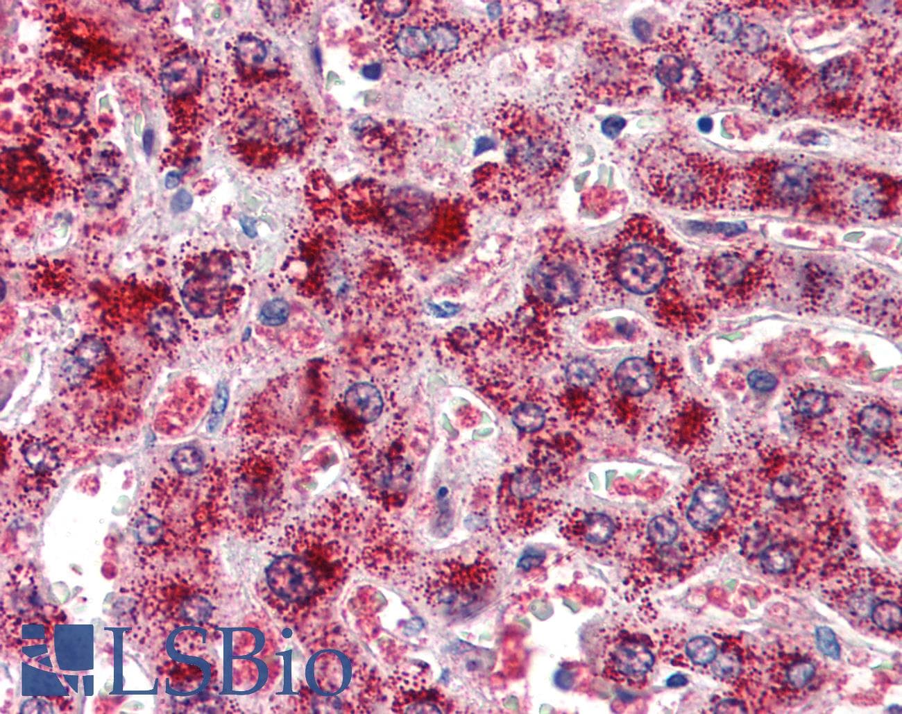IHC-plus™ CAT / Catalase Antibody (aa498-511)