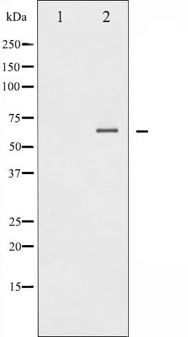 Polyclonal Rabbit anti-Human SYK Antibody (phospho-Tyr348, IHC, IF, WB)