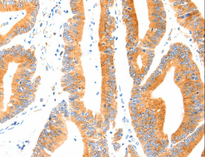 Polyclonal Rabbit anti-Human MANF / ARMET Antibody (IHC)