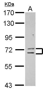 ZNF182 / ZNF21 Antibody