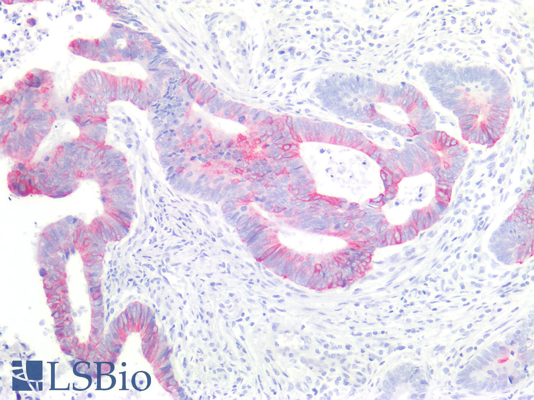 PathPlus™ Polyclonal Rabbit anti-Human KRT20 / CK20 / Cytokeratin 20 Antibody (clone E19-I, IHC)