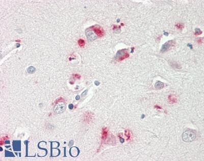 GPBB / PYGB Antibody (aa72-121)