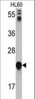 Polyclonal Rabbit anti-Human GLO1 / Glyoxalase I Antibody (aa23-51, IHC, IF, WB)