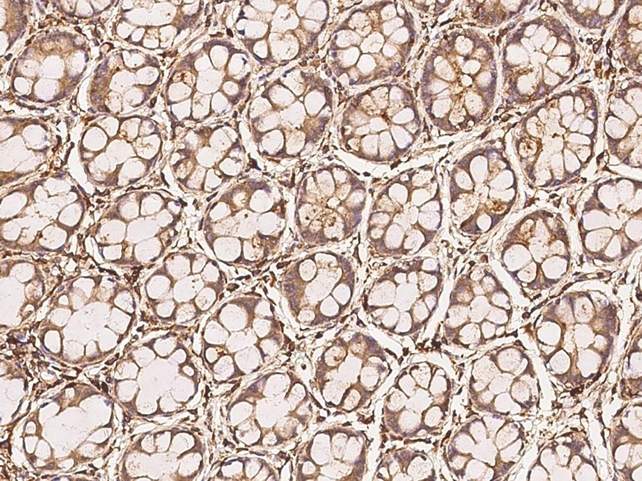 LRRK1 Antibody