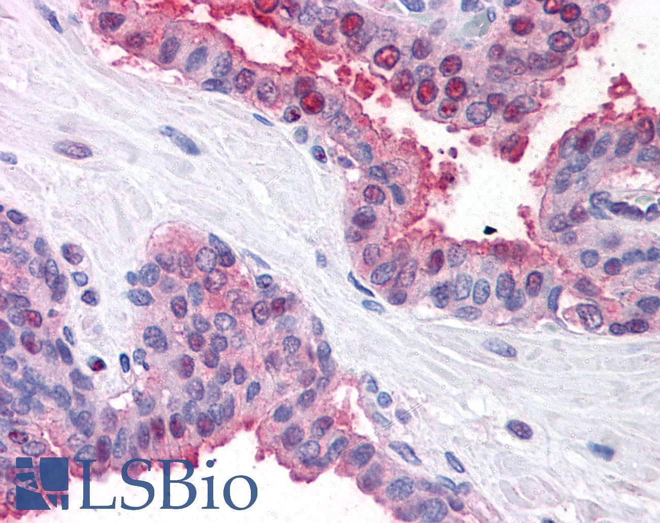 FANCD2 Antibody (N-Terminus, DY488)