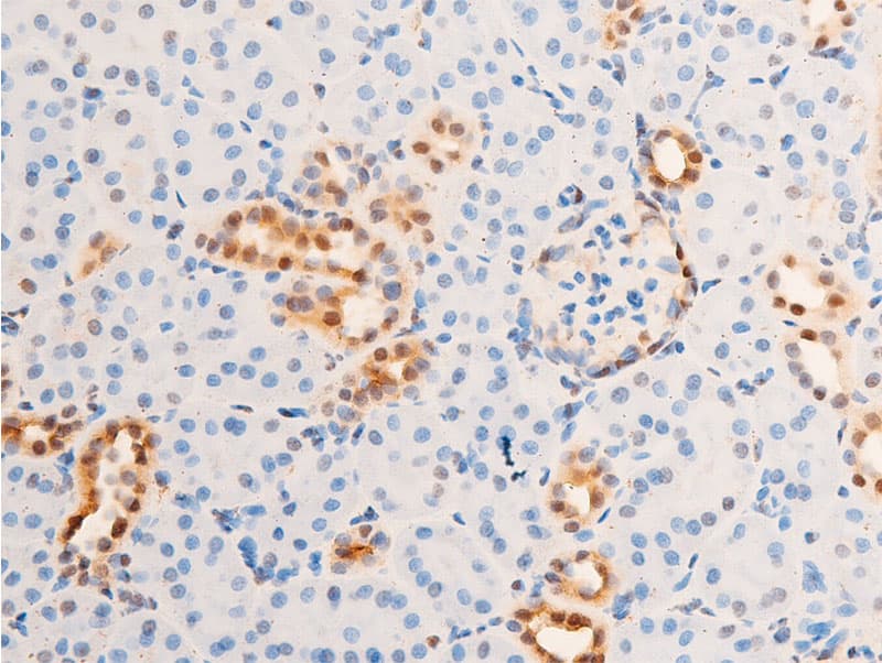 ERBB2 / HER2 Antibody (phospho-Tyr1248)