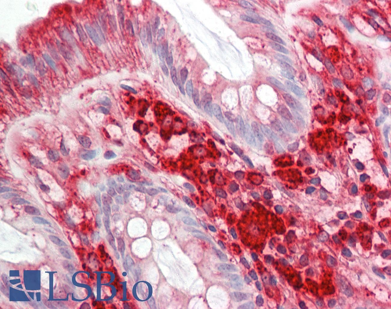 Polyclonal Rabbit anti-Human RAC1 Antibody (C-Terminus, IHC, WB)