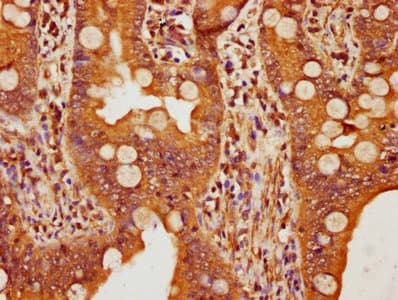 FBXW11 Antibody (aa1-140)