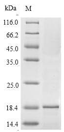 Apium graveolens Major allergen Api g 1, isoallergen 1 Protein (Recombinant 6His, N-terminus)