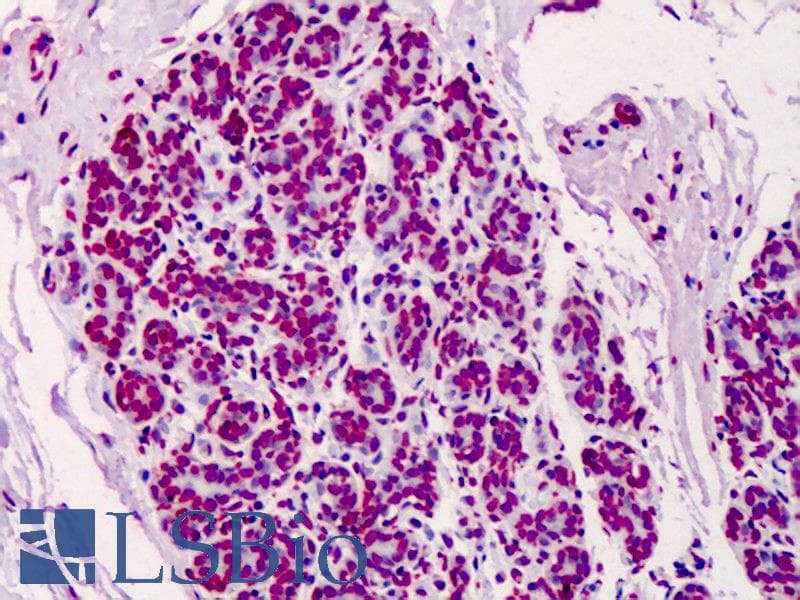 IHC-plus™ Monoclonal Mouse PAR / Poly ADP-Ribose Antibody (clone 10H, IHC, WB)