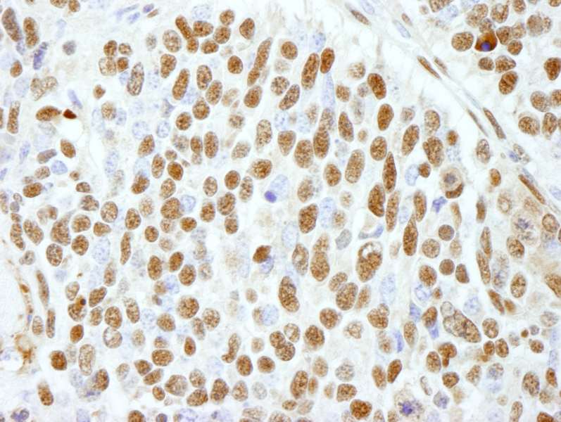 Polyclonal Rabbit anti-Human CTR9 Antibody (aa1123-1173, IHC)