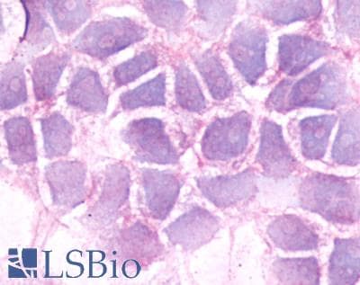 PathPlus™ Polyclonal Rabbit anti-Human BDKRB2/Bradykinin B2 Receptor Antibody (C-Terminus, IHC)