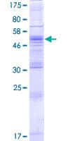 Human ZDHHC4 Protein (Recombinant GST)