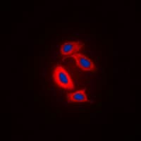 IHC-plus™ RAB31 Antibody (Internal)