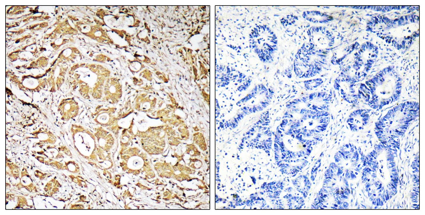 Polyclonal Rabbit anti-Human FUT3 Antibody (IHC, WB)