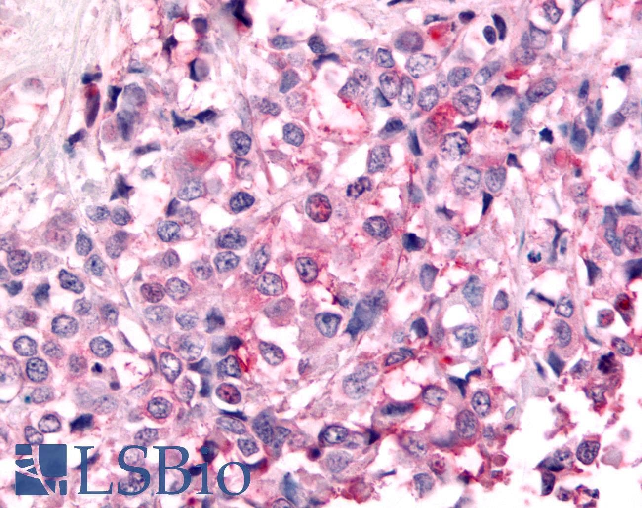 PathPlus™ Polyclonal Rabbit anti-Human PTPRE / PTP Epsilon Antibody (Cytoplasmic Domain, IHC)