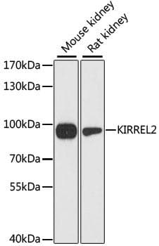 KIRREL2 / FILTRIN Antibody