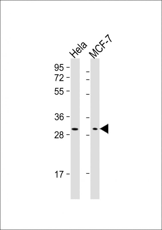 Monoclonal Mouse anti-Human RAB20 Antibody (clone 1694CT210.142.16, WB)