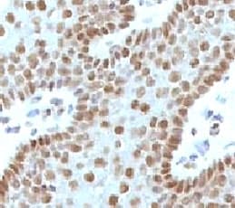 MYC / c-Myc Antibody (C-Terminus, clone MVH39-1)