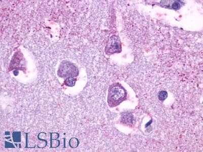 PathPlus™ HTR5A / 5-HT5A Receptor Antibody (Cytoplasmic Domain)