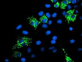 SIRT5 / Sirtuin 5 Antibody (clone OTI2A11)