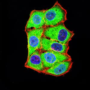 AXIN1 / Axin-1 Antibody (clone 4E9F1)