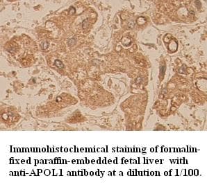 APOL1 / Apolipoprotein L Antibody (C-Terminus)