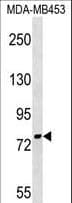 Polyclonal Rabbit anti-Human PNPT1 Antibody (aa284-311, WB)