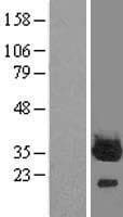 PROSC Protein (Over-Expression Lysate Myc-DDK (Flag))