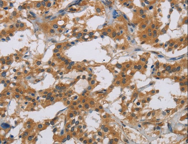 CDw218a / IL18R1 Antibody