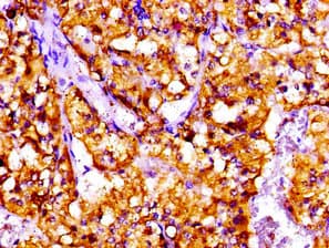 CTF1 / Cardiotrophin-1 Antibody