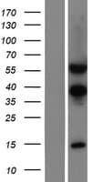 TSEN54 Protein (Over-Expression Lysate Myc-DDK (Flag))