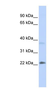 SRY Antibody (C-Terminus)