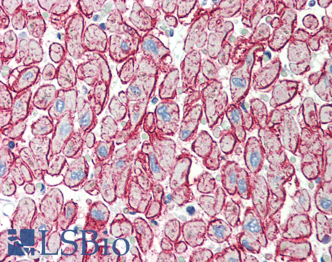 IHC-plus™ Polyclonal Rabbit anti-Human CDH13 / Cadherin 13 Antibody (IHC, IF, WB)