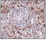 Polyclonal Rabbit anti-Human EBI3 / IL-27B Antibody (IHC, IF, WB)